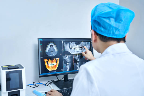 Best Knocked-Out Tooth (Avulsed Tooth) Treatment in Munfordville, KY